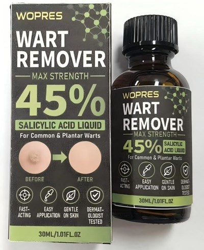 Wopres Wart Remover (Wopres Wart Remover)